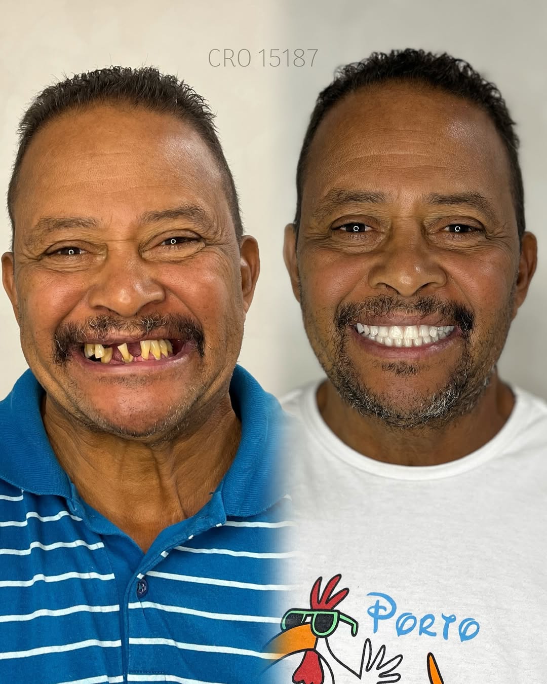 Transformação de Sorriso 11